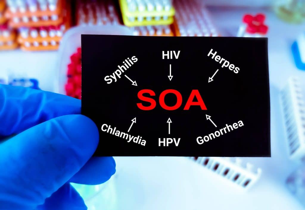 SOA test gratis?